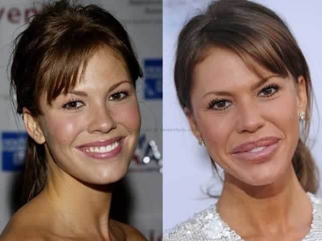tmpudw2vpaj Celebrities Who Spent Big on Transforming Their Looks