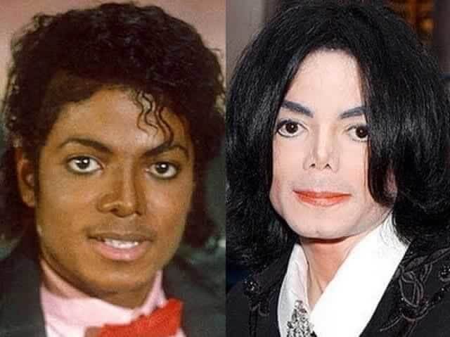 tmpudzypjix Celebrities Who Spent Big on Transforming Their Looks