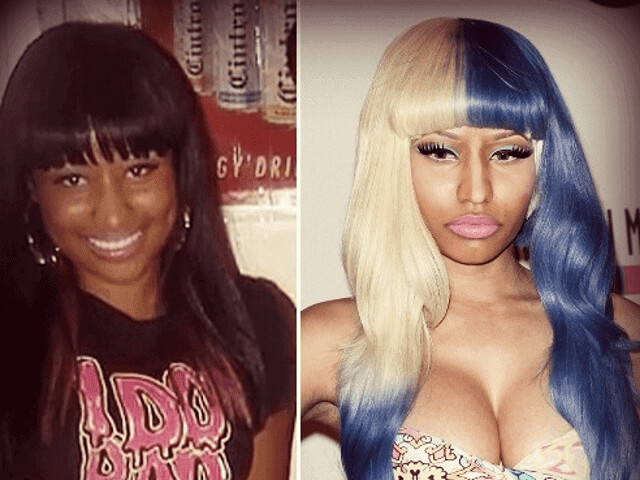 tmpupyb9u3y Celebrities Who Spent Big on Transforming Their Looks