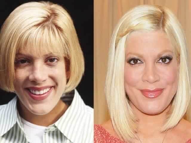 tmpuqc2787c Celebrities Who Spent Big on Transforming Their Looks