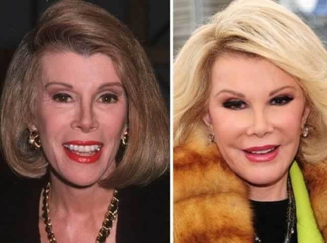 tmpv2ux0yhh Celebrities Who Spent Big on Transforming Their Looks
