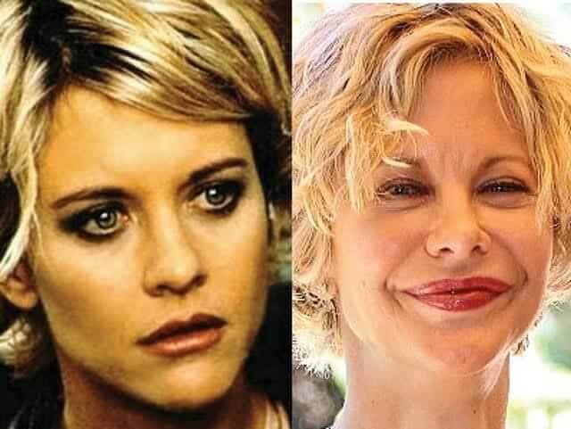 tmpvu_uanxt Celebrities Who Spent Big on Transforming Their Looks