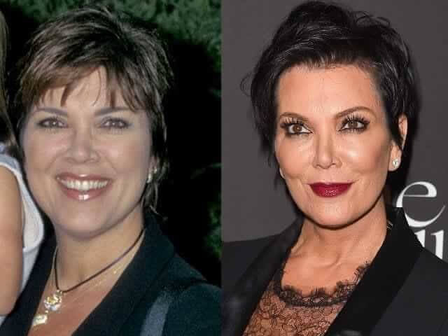 tmpxjsk0vcc Celebrities Who Spent Big on Transforming Their Looks