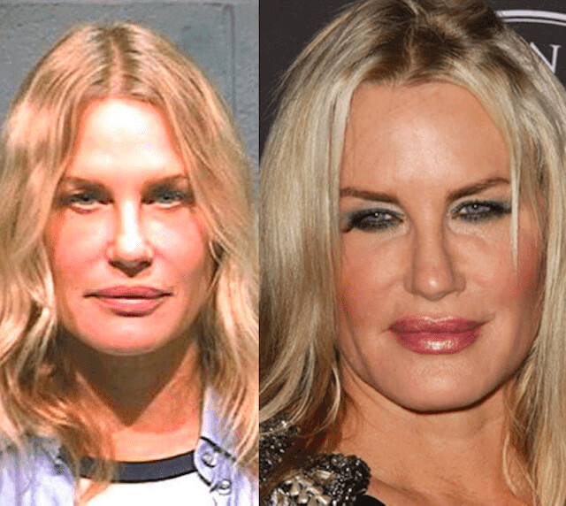 tmpxw0jp_l5 Celebrities Who Spent Big on Transforming Their Looks