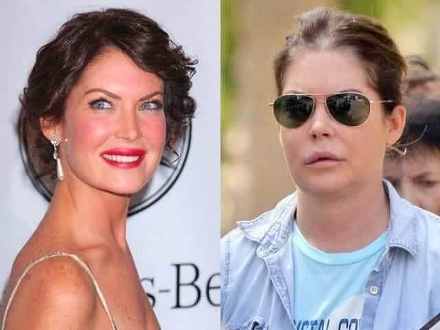 tmpxypr9aws Celebrities Who Spent Big on Transforming Their Looks