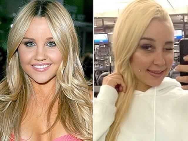 tmpydesc5_9 Celebrities Who Spent Big on Transforming Their Looks