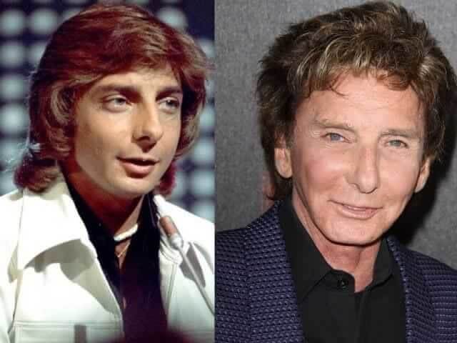 tmpyteeli41 Celebrities Who Spent Big on Transforming Their Looks